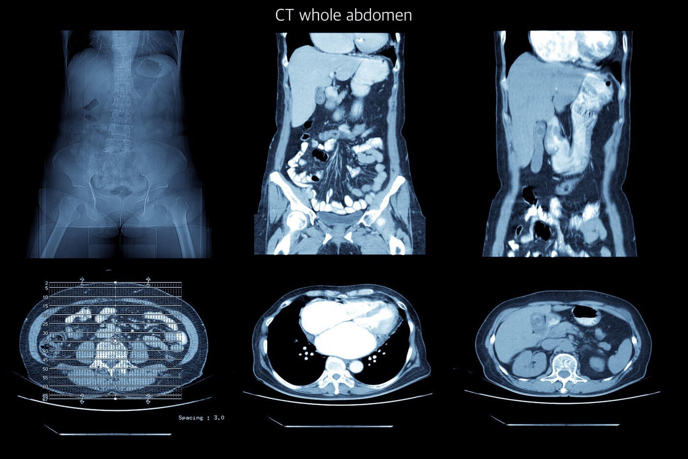 CT example